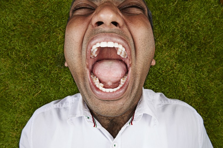 Vijay Kumar - Most Teeth In A Mouth
Guinness World Records 2014
Photo credit: Ranald Mackechnie/Guinness World Records